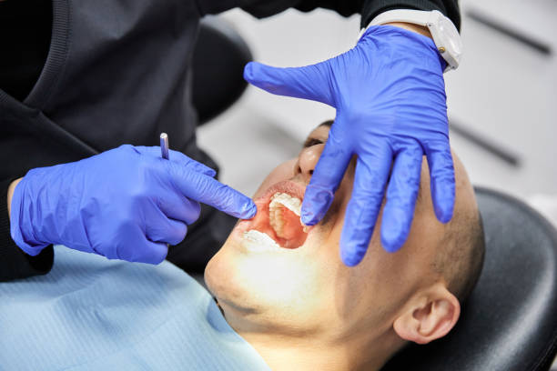 Best Dentist for Tooth Abscess  in Branson, MO